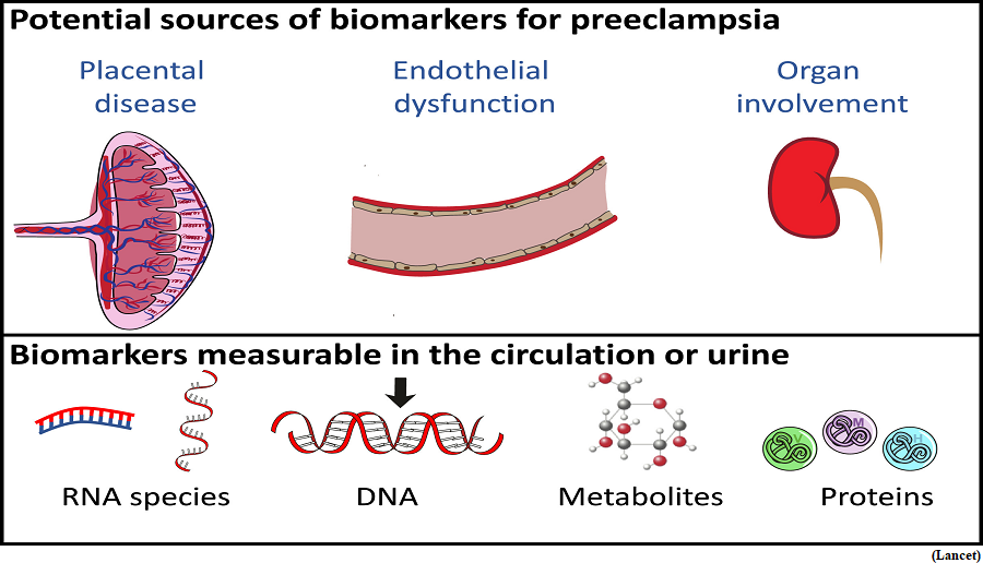 Early prediction of preeclampsia using a biomarker (GS Paper 3, Science and Technology)